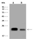 CRP2 Antibody in Western Blot (WB)