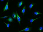 IFIT1 Antibody in Immunocytochemistry (ICC/IF)