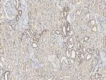 IFIT1 Antibody in Immunohistochemistry (Paraffin) (IHC (P))