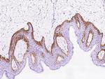 RAC3 Antibody in Immunohistochemistry (Paraffin) (IHC (P))