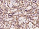 SLC19A3 Antibody in Immunohistochemistry (Paraffin) (IHC (P))