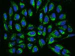 TIMM17B Antibody in Immunocytochemistry (ICC/IF)