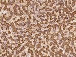 UNC13C Antibody in Immunohistochemistry (Paraffin) (IHC (P))