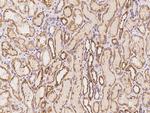 DNAH8 Antibody in Immunohistochemistry (Paraffin) (IHC (P))