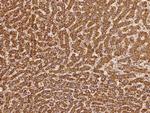 DNAH8 Antibody in Immunohistochemistry (Paraffin) (IHC (P))