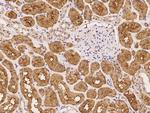 ARHGAP21 Antibody in Immunohistochemistry (Paraffin) (IHC (P))