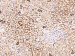 AHCTF1 Antibody in Immunohistochemistry (Paraffin) (IHC (P))