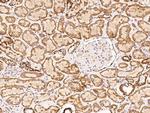 COQ2 Antibody in Immunohistochemistry (Paraffin) (IHC (P))