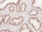 COQ2 Antibody in Immunohistochemistry (Paraffin) (IHC (P))