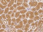 ATP13A3 Antibody in Immunohistochemistry (Paraffin) (IHC (P))