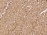 ATP13A3 Antibody in Immunohistochemistry (Paraffin) (IHC (P))