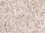 SLX1A Antibody in Immunohistochemistry (Paraffin) (IHC (P))