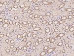 MLK3 Antibody in Immunohistochemistry (Paraffin) (IHC (P))