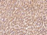 MLK3 Antibody in Immunohistochemistry (Paraffin) (IHC (P))