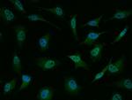 TBX3 Antibody in Immunocytochemistry (ICC/IF)