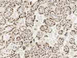 TBX3 Antibody in Immunohistochemistry (Paraffin) (IHC (P))