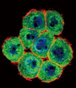 SMAD4 Antibody in Immunocytochemistry (ICC/IF)