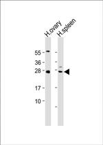 NTF3 Antibody in Western Blot (WB)