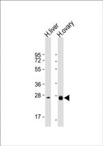 NTF3 Antibody in Western Blot (WB)