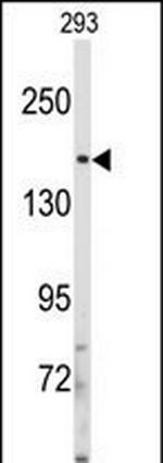 IRS2 Antibody in Western Blot (WB)