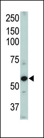 ACVRL1 Antibody in Western Blot (WB)