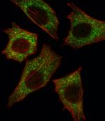 B-Raf Antibody in Immunocytochemistry (ICC/IF)