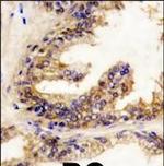 B-Raf Antibody in Immunohistochemistry (Paraffin) (IHC (P))