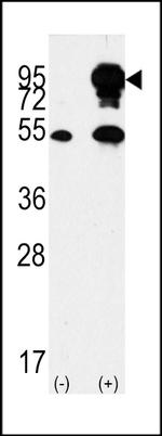 B-Raf Antibody in Western Blot (WB)