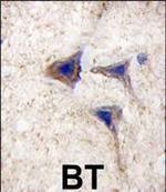 B-Raf Antibody in Immunohistochemistry (Paraffin) (IHC (P))