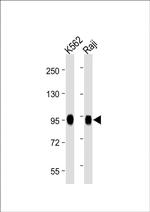 B-Raf Antibody in Western Blot (WB)