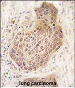 RIP2 Antibody in Immunohistochemistry (Paraffin) (IHC (P))