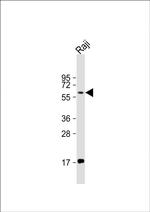 RIP2 Antibody in Western Blot (WB)