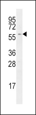 RIP2 Antibody in Western Blot (WB)