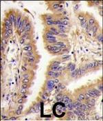 TGM2 Antibody in Immunohistochemistry (Paraffin) (IHC (P))