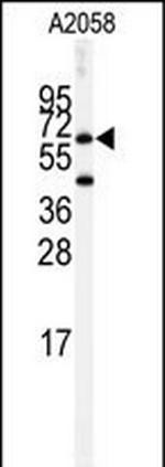 Butyrylcholinesterase Antibody in Western Blot (WB)