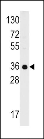 C1QBP Antibody in Western Blot (WB)