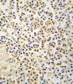 ALDH1A3 Antibody in Immunohistochemistry (Paraffin) (IHC (P))