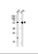 ALDH1A3 Antibody in Western Blot (WB)