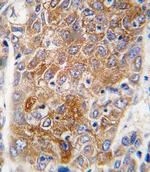 ALDH1L1 Antibody in Immunohistochemistry (Paraffin) (IHC (P))