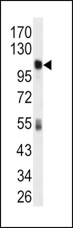 ALDH1L1 Antibody in Western Blot (WB)