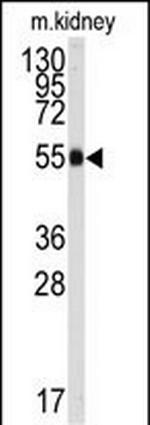 ALDH9A1 Antibody in Western Blot (WB)