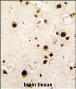 HnRNP Q Antibody in Immunohistochemistry (Paraffin) (IHC (P))