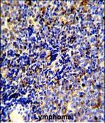 MERTK Antibody in Immunohistochemistry (Paraffin) (IHC (P))