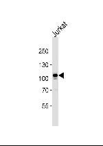 MERTK Antibody in Western Blot (WB)