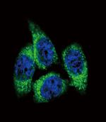 CYP17A1 Antibody in Immunocytochemistry (ICC/IF)