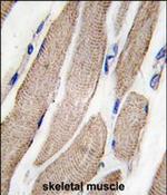 MEK5 Antibody in Immunohistochemistry (Paraffin) (IHC (P))