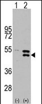 MEK5 Antibody in Western Blot (WB)