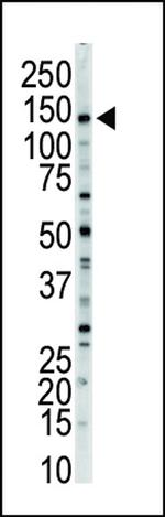 MYLK Antibody in Western Blot (WB)