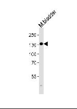 MYLK Antibody in Western Blot (WB)