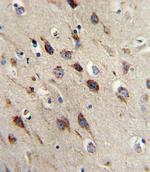 BDNF Antibody in Immunohistochemistry (Paraffin) (IHC (P))